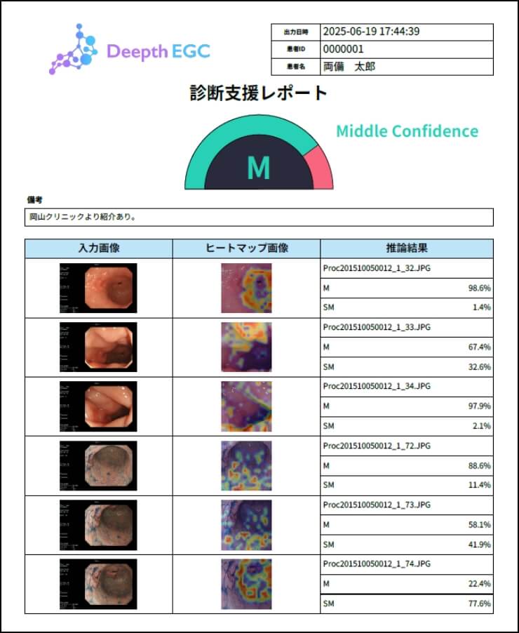 早期胃癌深達度診断支援システム Deepth-EGC 診断支援レポート イメージ